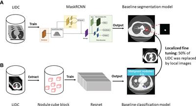 Impact of localized fine tuning in the performance of segmentation and classification of lung nodules from computed tomography scans using deep learning